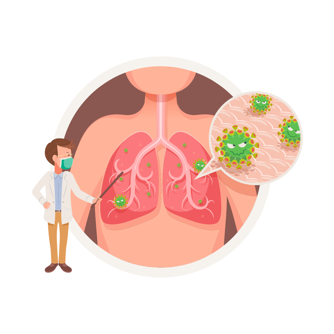 Pneumonia Symptoms Causes And Support With Essential Oils EoASSIST pneumonia-symptoms-causes-and-support-with-essential-oils-eoassist